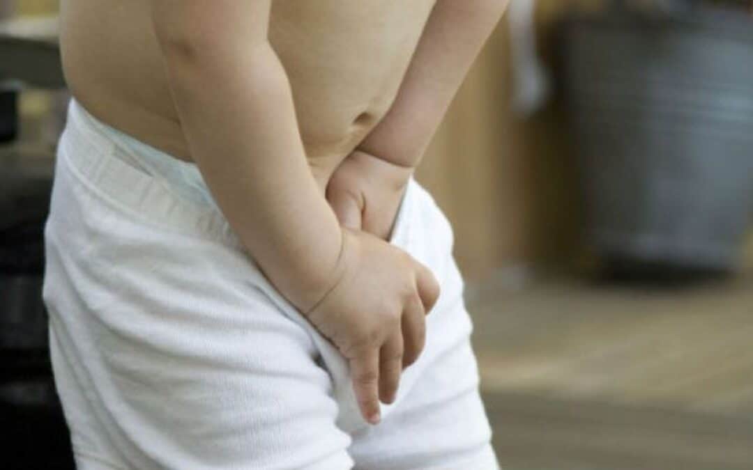 Fimosis en niños