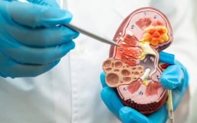 Litotricia: tratamiento no invasivo para cálculos renales